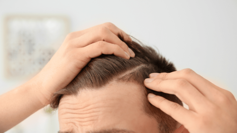 effective solutions for thinning hairs
