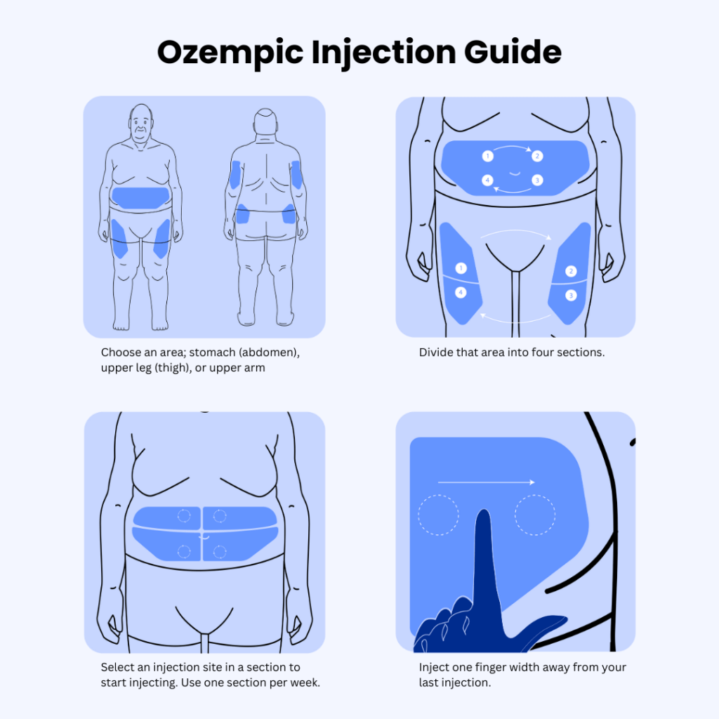 Best Ozempic Injection Sites 