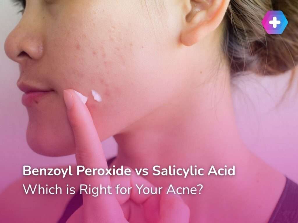 Benzoyl Peroxide vs Salicylic Acid: Which is Right for Your Acne?