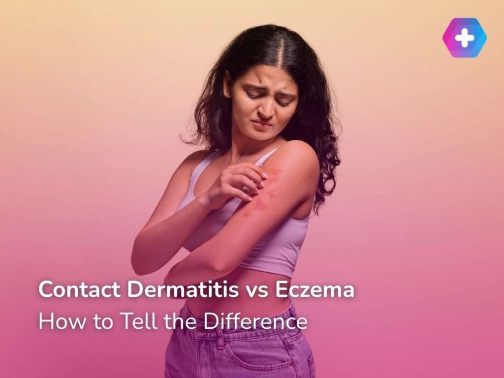Contact Dermatitis vs Eczema and How to Tell the Difference