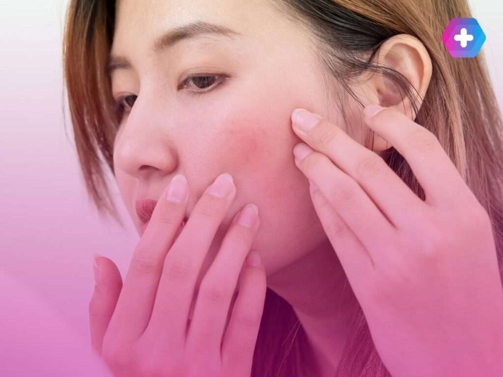 How to Combat Dermatitis on the Face | The Care Pharmacy