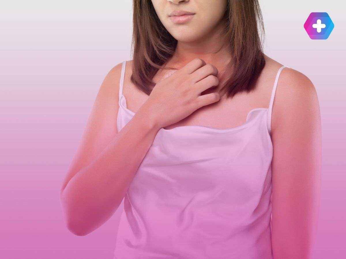 young woman scratching eczema rash on her neck