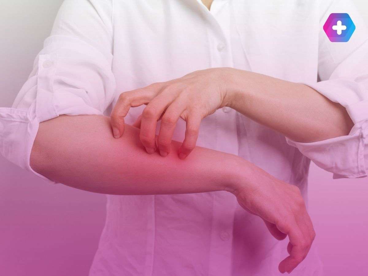 person in white shirt scratching eczema rash on their arm