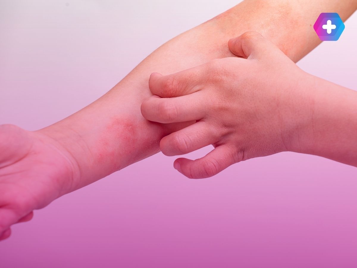 person scratching eczema rash on their arm