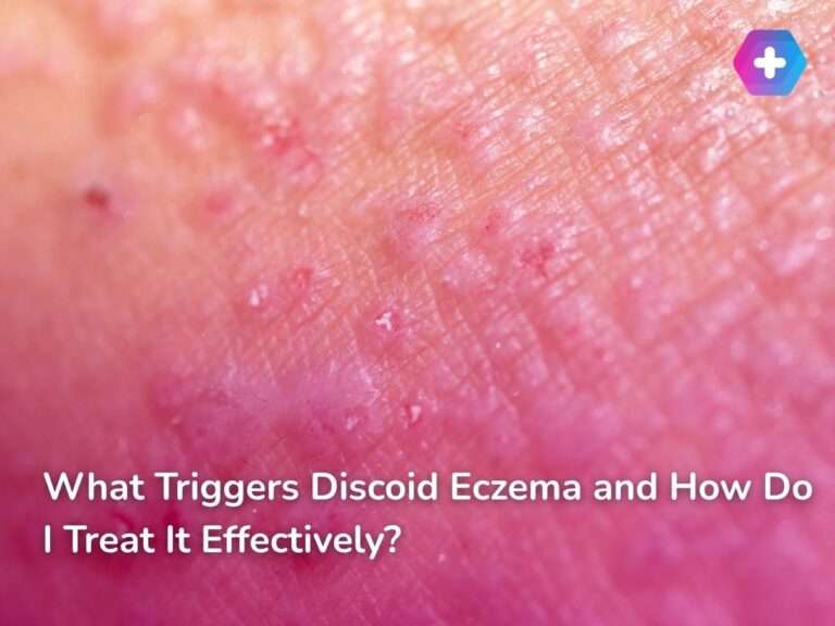 What Triggers Discoid Eczema and How Do I Treat It Effectively?