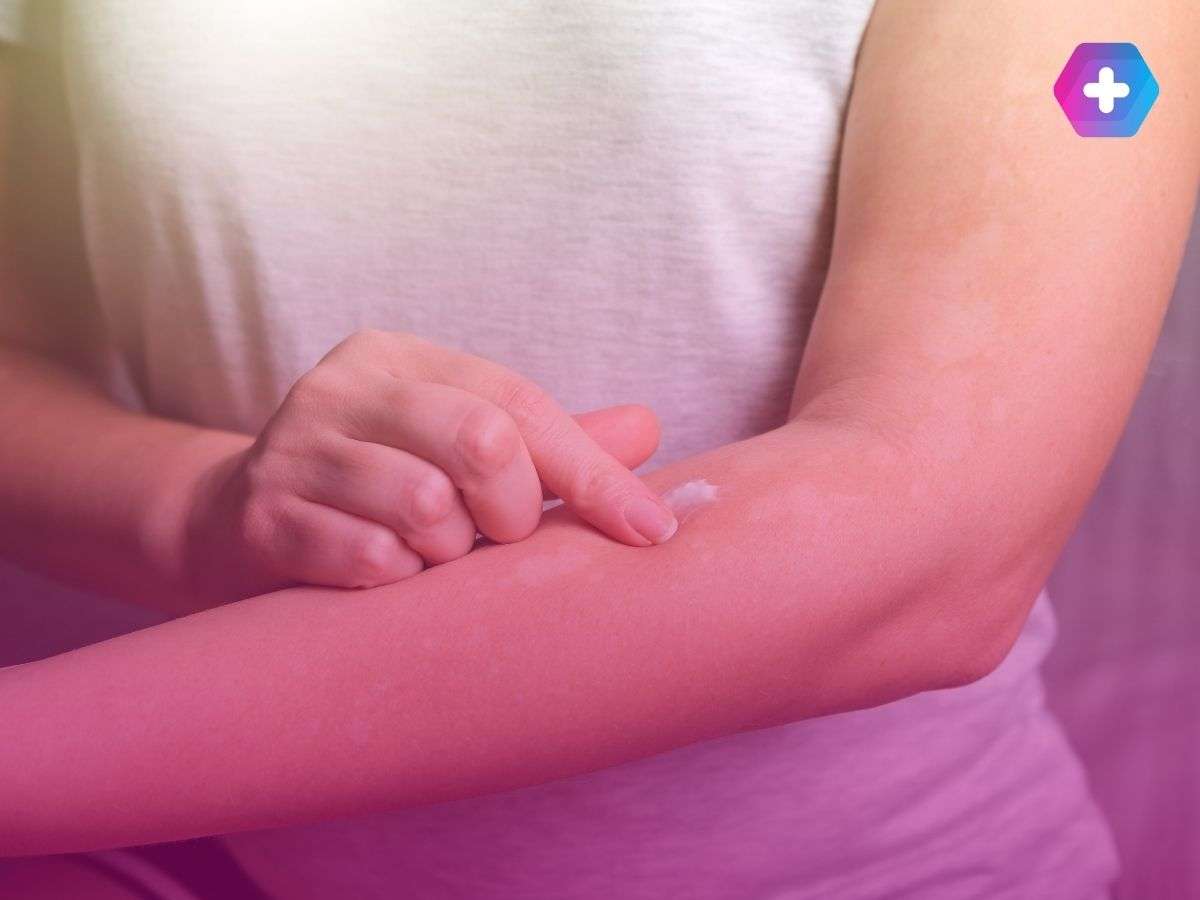 person in white shirt applying skin cream to their arm