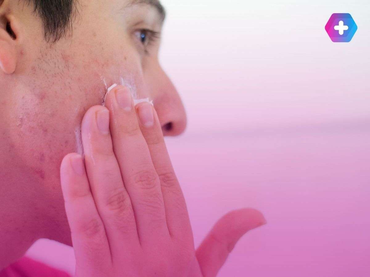 person applying cream to acne on their face