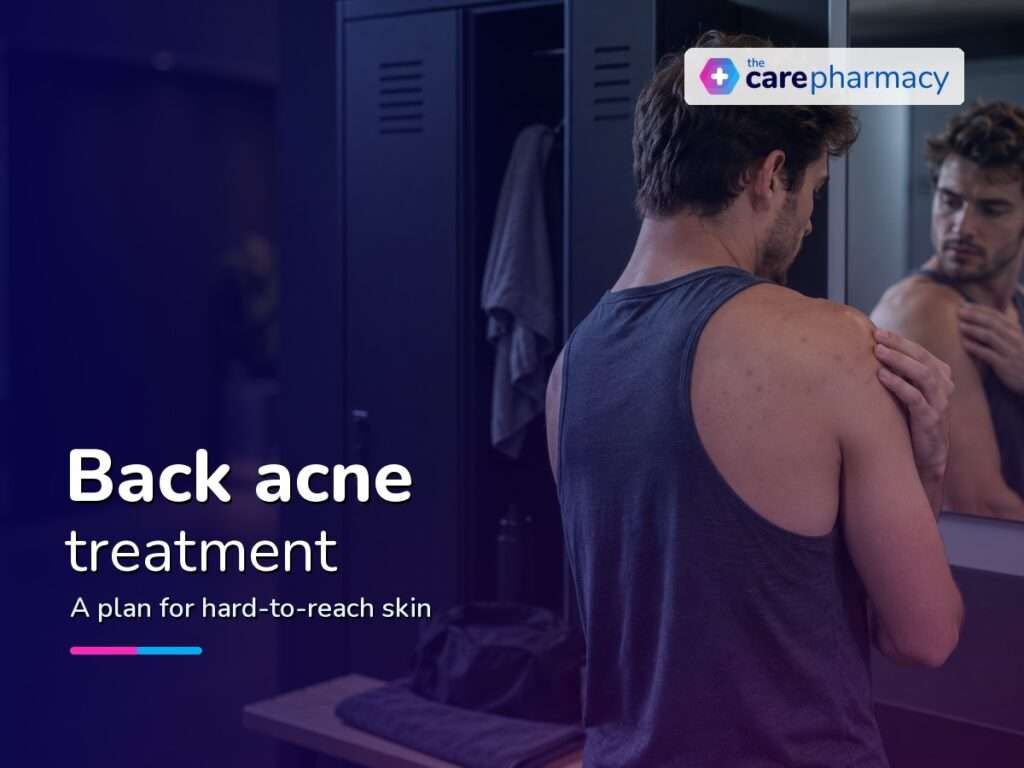Back Acne Treatment: Creams, Tablets and When to Seek Help