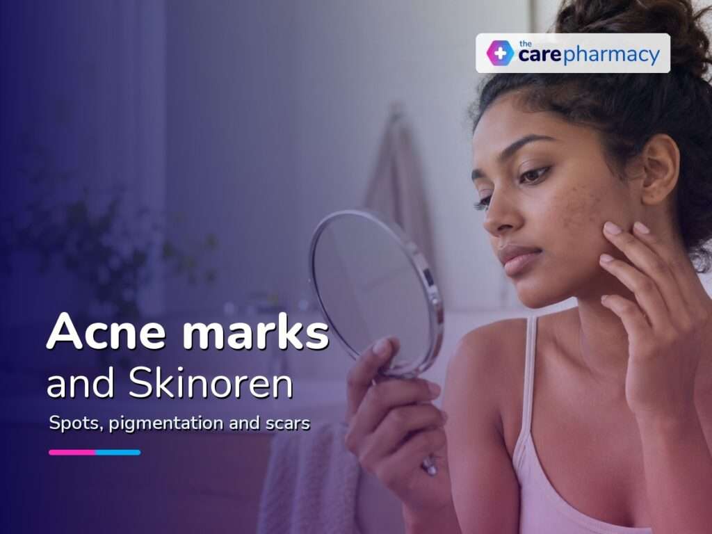 Skinoren for Acne Marks: Dark Marks, Spots and Scars
